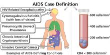 Gráfico de ejemplos de varias afecciones que definen el SIDA.