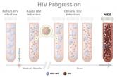 Graphic of HIV progression: before infection, acute HIV infection, chronic HIV infection, and AIDS.