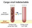 Los medicamentos contra el VIH reducen la carga viral hasta niveles indetectables.