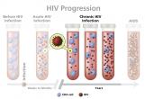 Progression of HIV infection to AIDS illustrated with test tubes, CD4 cells, and virions.