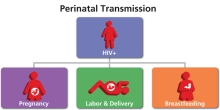 La transmisión del VIH de una madre a su bebé.