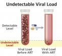 HIV medicines reduce viral loads to undetectable levels.