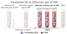 La evolución de la infección por el VIH al SIDA ilustrada con tubos de ensayo, células CD4, y partículas del virus.