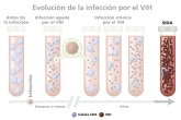 Gráfico de progresión del VIH: antes de la infección, infección aguda por VIH, infección crónica por VIH y SIDA.