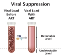 HIV viral load is reduced to an undetectable level with ART.