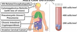 Conditions that lead to an AIDS diagnosis