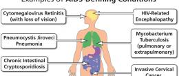 Examples of AIDS-defining conditions, included in the Centers for Disease Control and Prevention’s list of diagnostic criteria for AIDS.