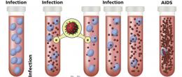 Graphic of HIV progression: before infection, acute HIV infection, chronic HIV infection, and AIDS.