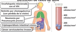 Afecciones que llevan a un diagnóstico del SIDA.