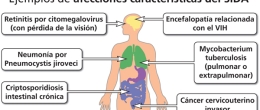 Ejemplos de condiciones que definen el SIDA, incluidas en la lista de criterios de diagnóstico del SIDA de los Centros para el Control y la Prevención de Enfermedades