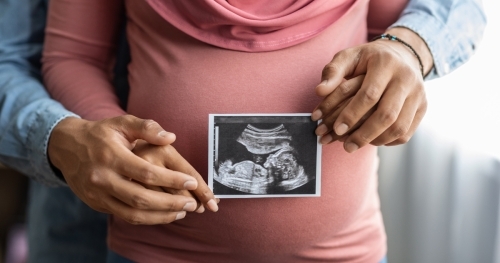 Expecting parents holding their hands and showing the ultrasound image of their future baby.