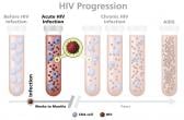 Graph of acute HIV infection that extends approximately 2 to 4 weeks until the body produces enough HIV antibodies to be detected by a test.