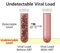 HIV medicines reduce viral loads to undetectable levels.