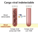 Se suprime una infección por el VIH hasta niveles indetectables con el tratamiento contra el VIH. 