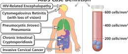 Conditions that lead to an AIDS diagnosis