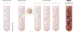 Graphic of HIV progression: before infection, acute HIV infection, chronic HIV infection, and AIDS.