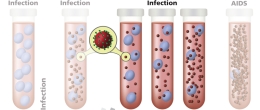 Progression of HIV infection to AIDS illustrated with test tubes, CD4 cells, and virions.