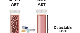 HIV viral load is reduced to an undetectable level with ART.